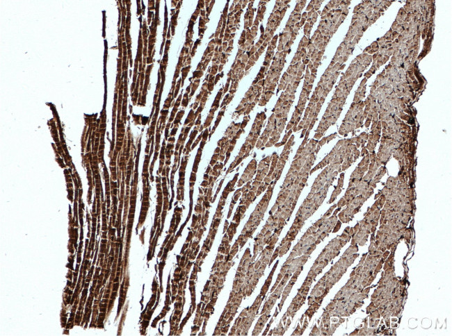 TSPO/PBR Antibody in Immunohistochemistry (Paraffin) (IHC (P))