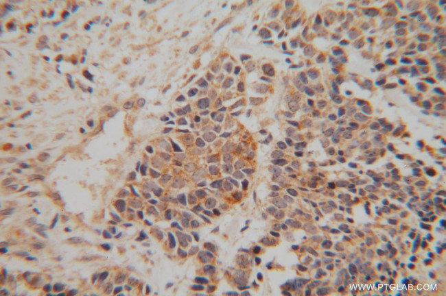 NDUFA6 Antibody in Immunohistochemistry (Paraffin) (IHC (P))