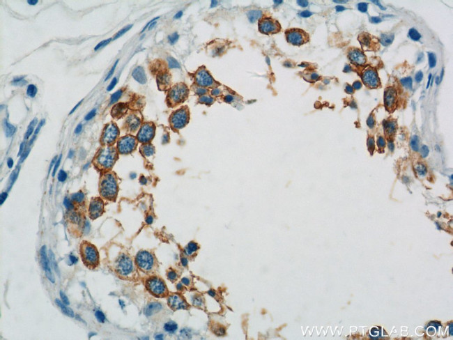 TEX101 Antibody in Immunohistochemistry (Paraffin) (IHC (P))