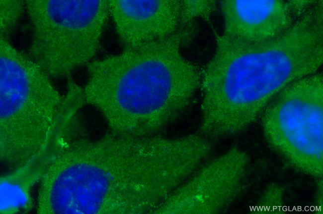 S100A2 Antibody in Immunocytochemistry (ICC/IF)