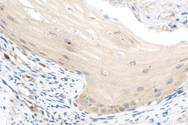 WIT1 Antibody in Immunohistochemistry (Paraffin) (IHC (P))