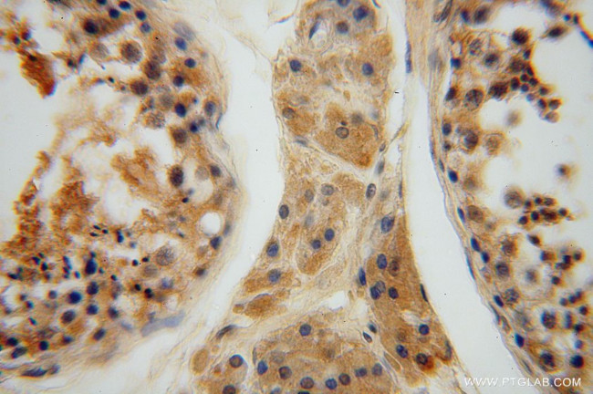 HIP14/ZDHHC17 Antibody in Immunohistochemistry (Paraffin) (IHC (P))
