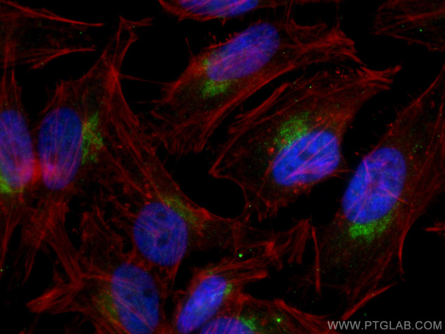 YIPF4 Antibody in Immunocytochemistry (ICC/IF)