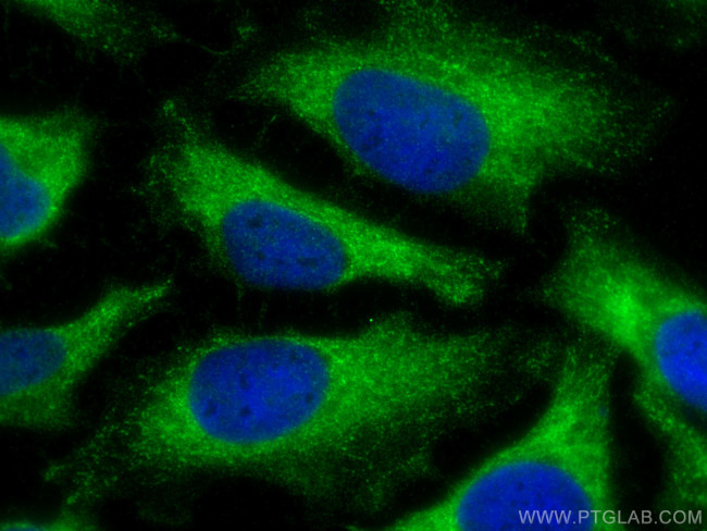 NAT6/FUS2 Antibody in Immunocytochemistry (ICC/IF)