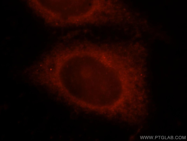 OSBPL10 Antibody in Immunocytochemistry (ICC/IF)