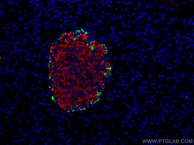 Pancreatic Polypeptide Antibody in Immunocytochemistry (ICC/IF)