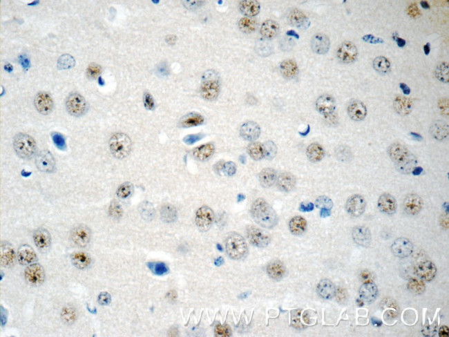 RUNX1T1 Antibody in Immunohistochemistry (Paraffin) (IHC (P))