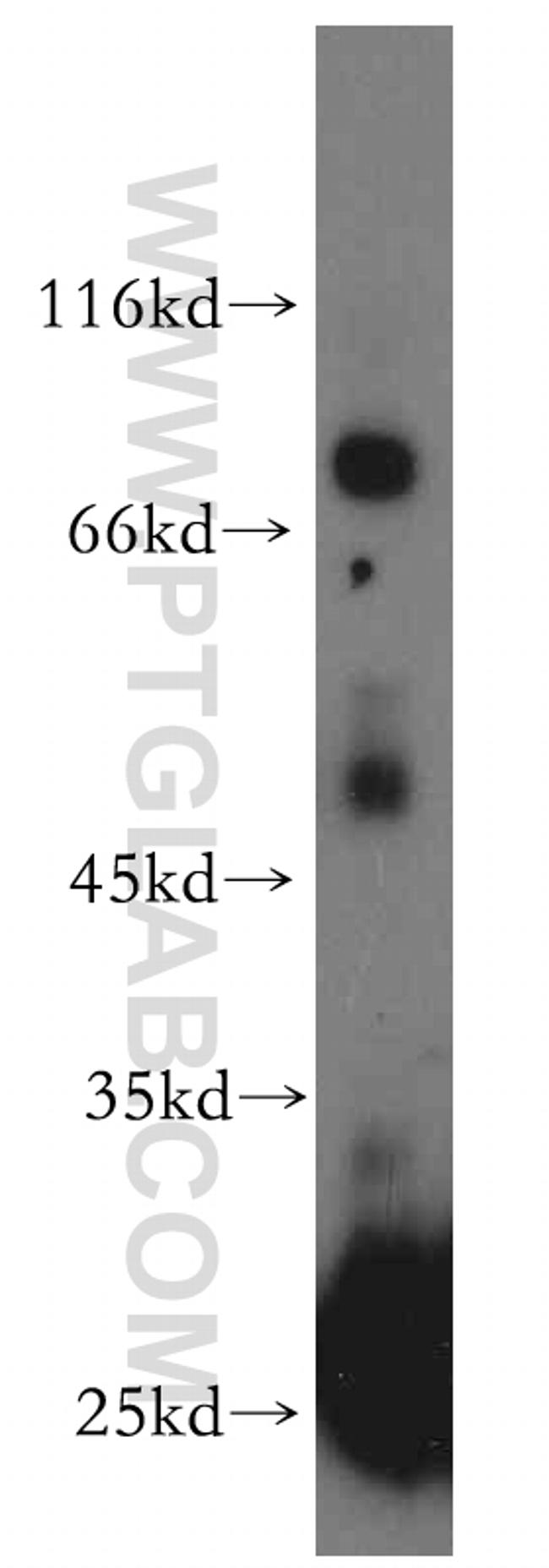 SPO11 Antibody in Western Blot (WB)