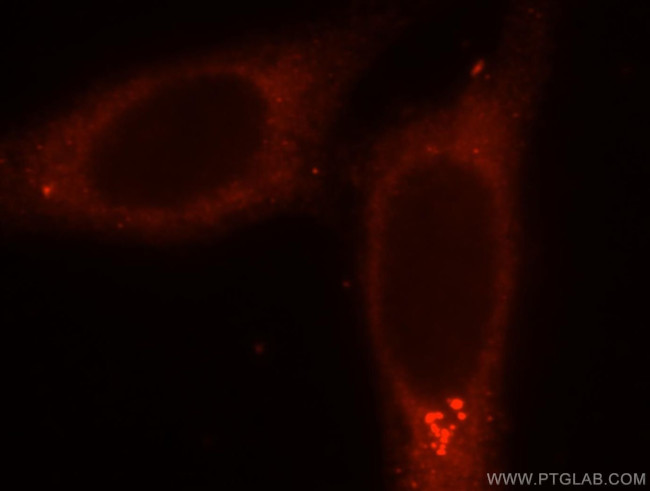 SMU1 Antibody in Immunocytochemistry (ICC/IF)