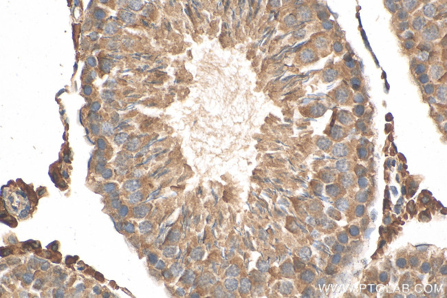 HSD3B2 Antibody in Immunohistochemistry (Paraffin) (IHC (P))