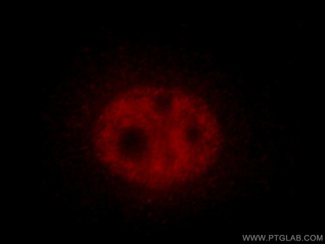 SF3B5 Antibody in Immunocytochemistry (ICC/IF)