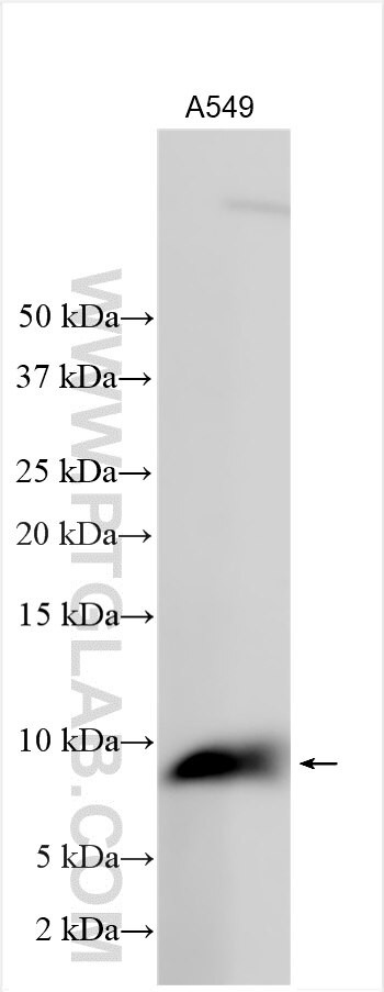 DHRS7B Antibody in Western Blot (WB)