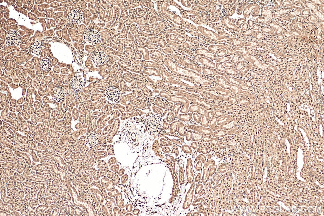 PPM1G Antibody in Immunohistochemistry (Paraffin) (IHC (P))