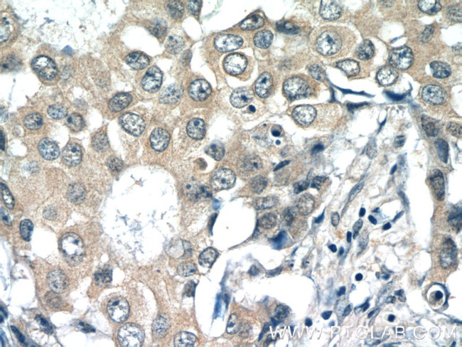 RPL36AL Antibody in Immunohistochemistry (Paraffin) (IHC (P))