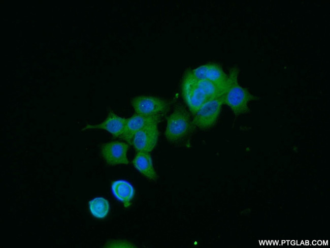 NTF2 Antibody in Immunocytochemistry (ICC/IF)