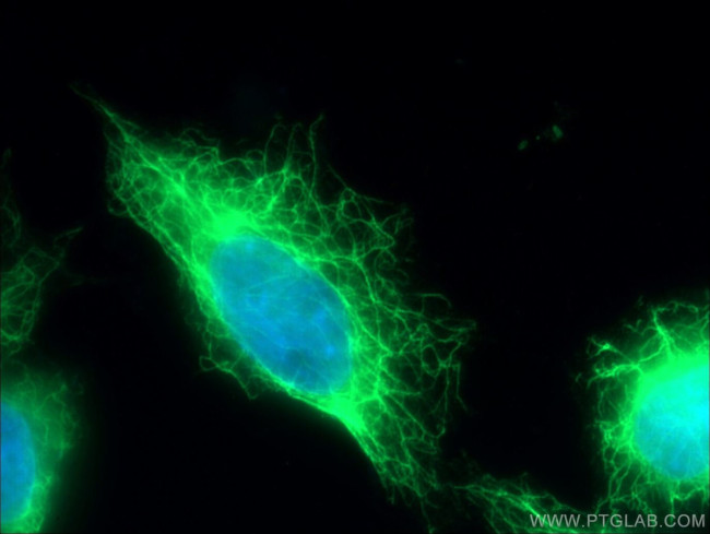 Cytokeratin 7 Antibody in Immunocytochemistry (ICC/IF)