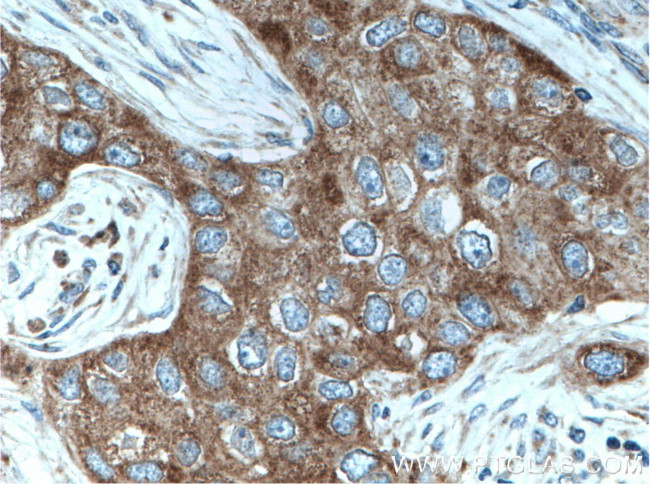 MRPL49 Antibody in Immunohistochemistry (Paraffin) (IHC (P))