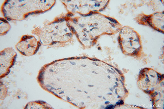 PDIR Antibody in Immunohistochemistry (Paraffin) (IHC (P))