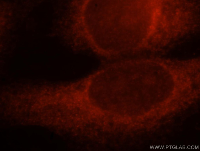 KCTD2/5/17 Antibody in Immunocytochemistry (ICC/IF)