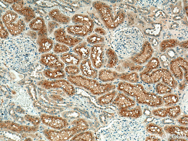 Syntaxin 3 Antibody in Immunohistochemistry (Paraffin) (IHC (P))