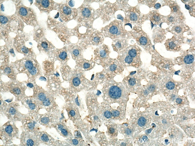 NDUFA1 Antibody in Immunohistochemistry (Paraffin) (IHC (P))