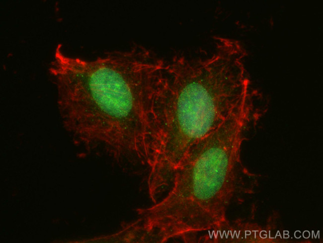 SEH1L Antibody in Immunocytochemistry (ICC/IF)