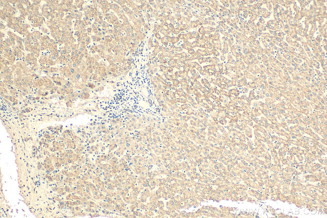 NDUFB9 Antibody in Immunohistochemistry (Paraffin) (IHC (P))