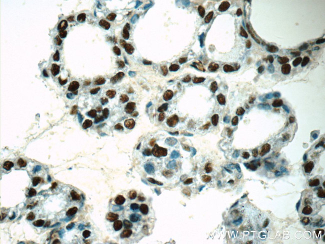 GMCL1 Antibody in Immunohistochemistry (Paraffin) (IHC (P))
