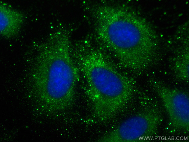 HIG2 Antibody in Immunocytochemistry (ICC/IF)