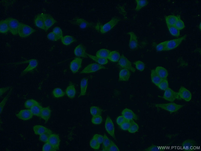 ZAP70 Antibody in Immunocytochemistry (ICC/IF)