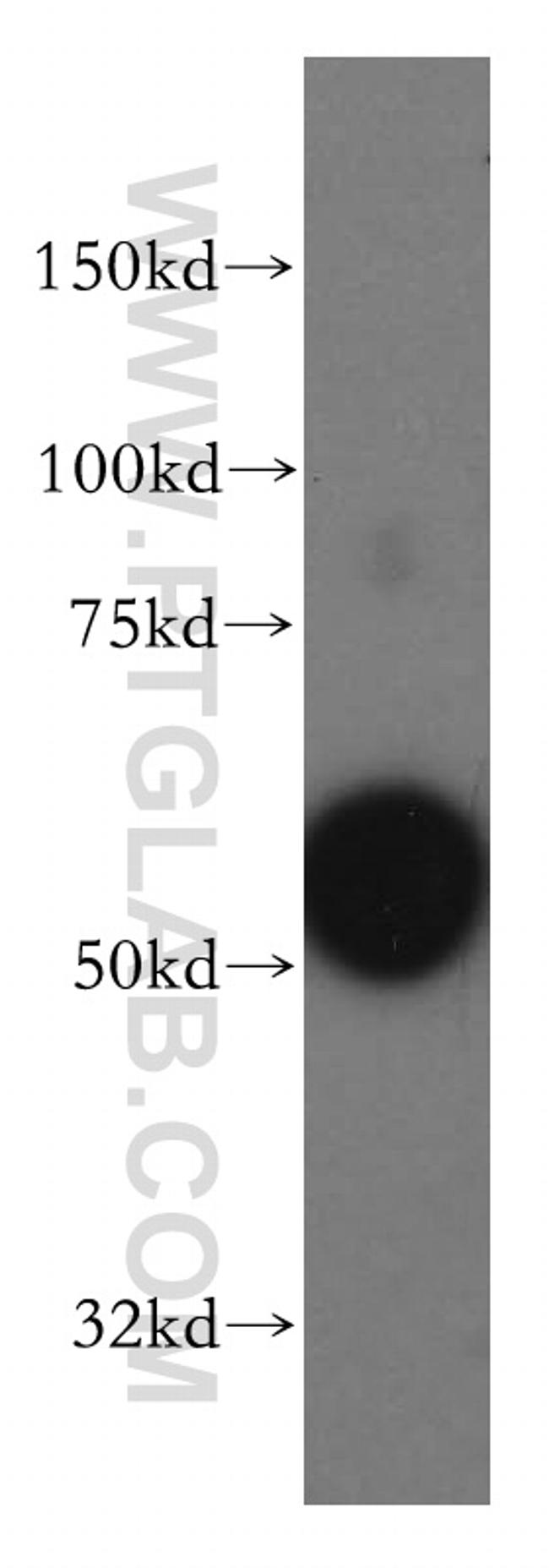 LSP1 Antibody in Western Blot (WB)