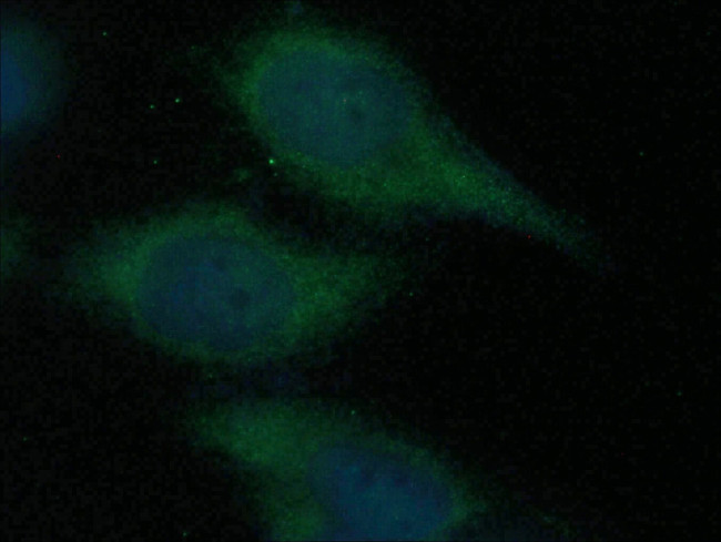 CDCA3 Antibody in Immunocytochemistry (ICC/IF)