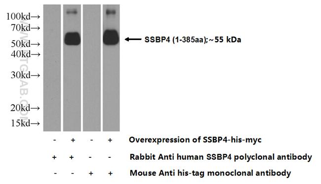 SSBP4 Antibody in Western Blot (WB)