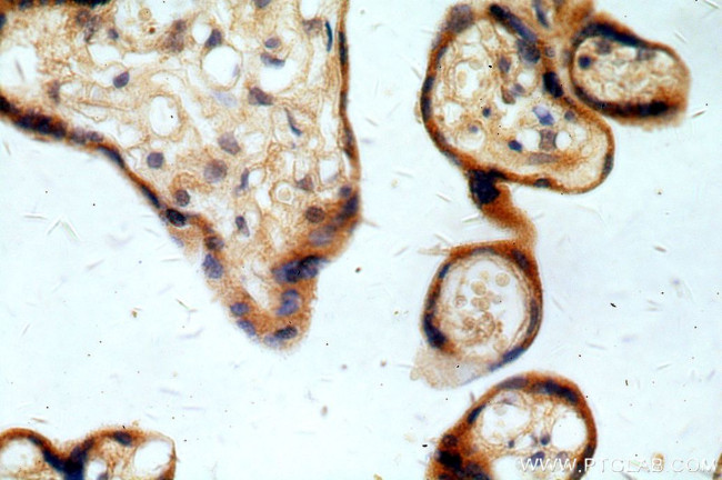 REXO2 Antibody in Immunohistochemistry (Paraffin) (IHC (P))