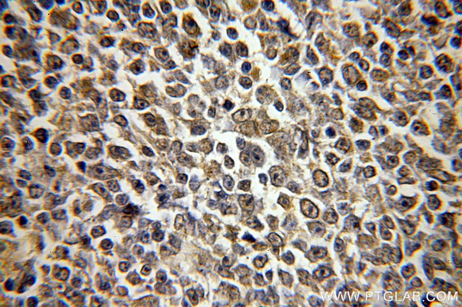 HMGB2 Antibody in Immunohistochemistry (Paraffin) (IHC (P))