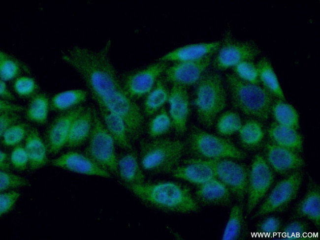 RNASEH1 Antibody in Immunocytochemistry (ICC/IF)