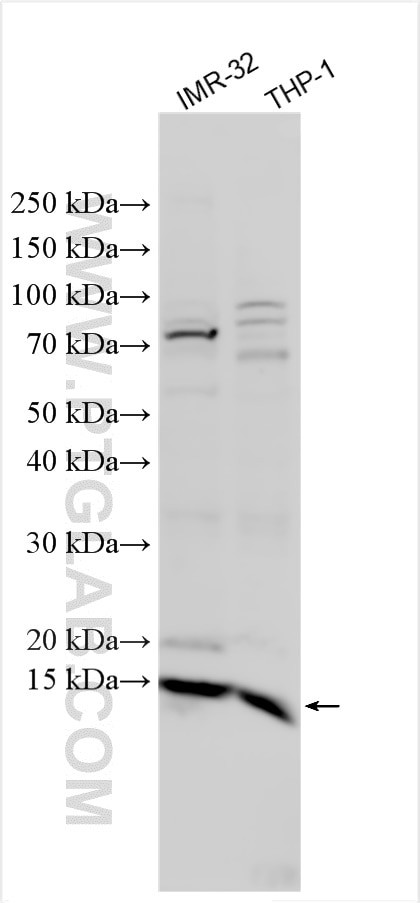 CUTA Antibody in Western Blot (WB)