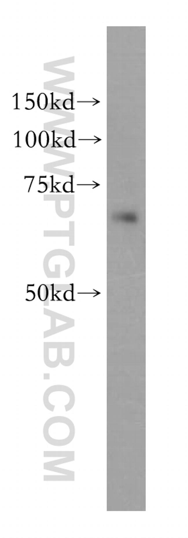 KLHL13 Antibody in Western Blot (WB)