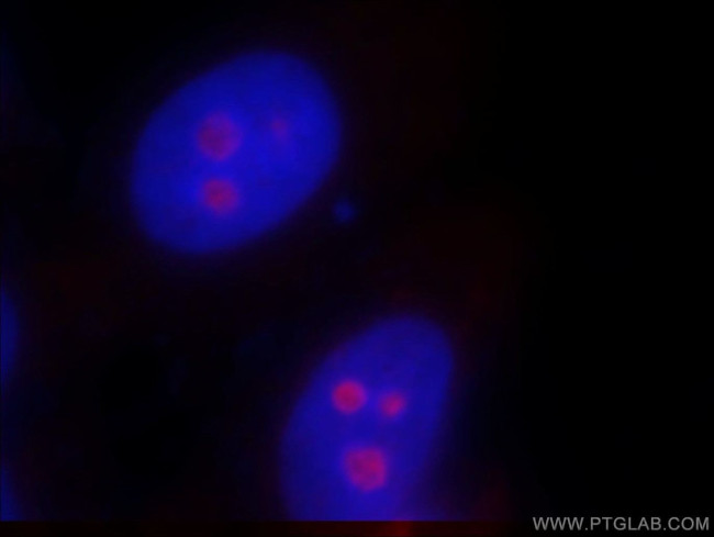 SF4 Antibody in Immunocytochemistry (ICC/IF)
