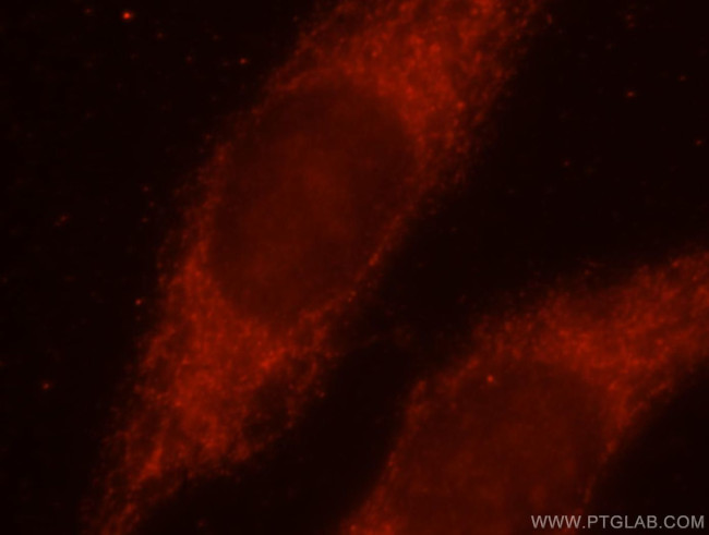 AKAP1 Antibody in Immunocytochemistry (ICC/IF)