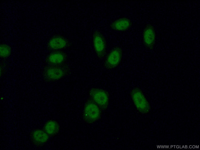 RNF40 Antibody in Immunocytochemistry (ICC/IF)