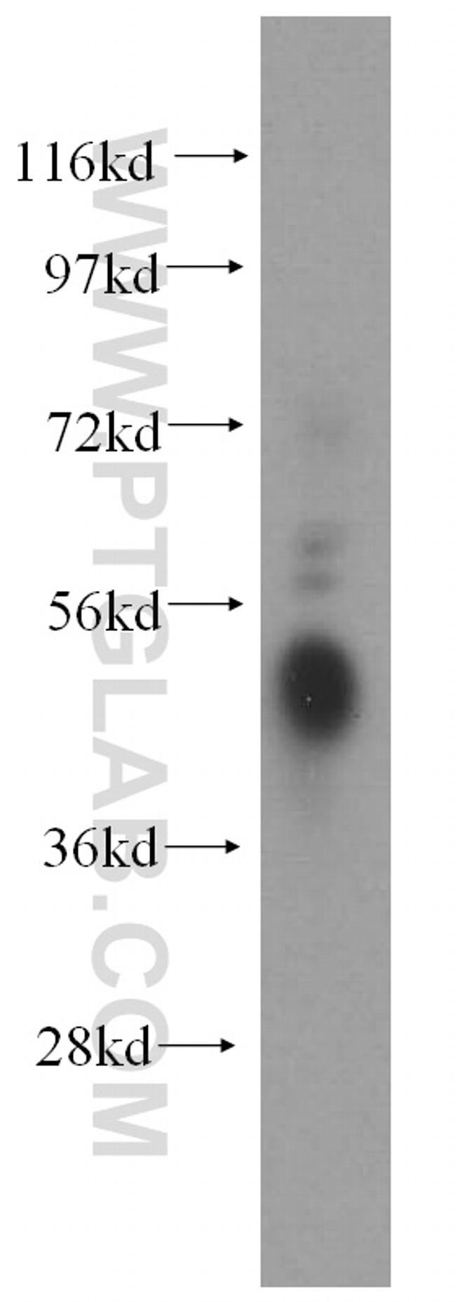 FCGR2A / CD32a Antibody in Western Blot (WB)