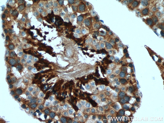 NRD1 Antibody in Immunohistochemistry (Paraffin) (IHC (P))