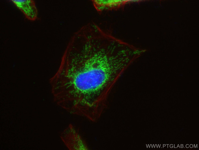 HSDL2 Antibody in Immunocytochemistry (ICC/IF)
