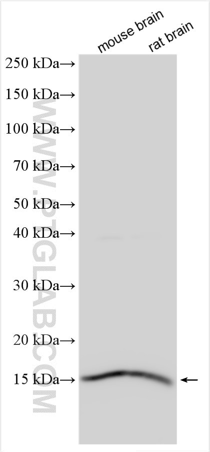 AP2S1 Antibody in Western Blot (WB)