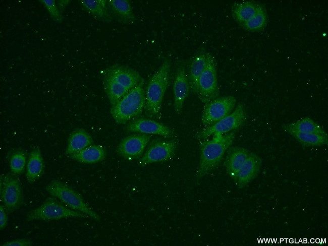 ADPGK Antibody in Immunocytochemistry (ICC/IF)
