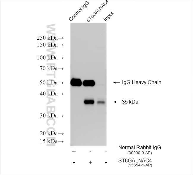ST6GALNAC4 Antibody in Immunoprecipitation (IP)