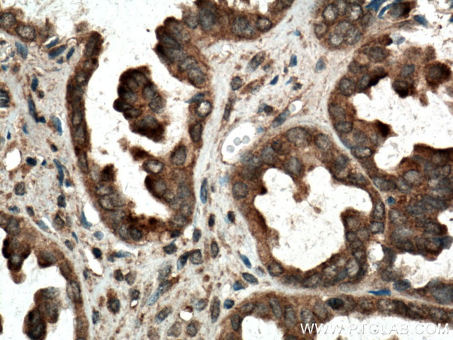 RAB14 Antibody in Immunohistochemistry (Paraffin) (IHC (P))