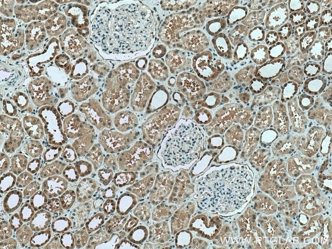 PPIL3 Antibody in Immunohistochemistry (Paraffin) (IHC (P))