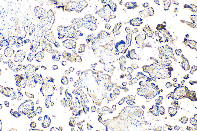 Collagen Type XXVII Antibody in Immunohistochemistry (Paraffin) (IHC (P))